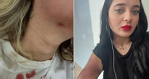 Eski sevgilisinin saldırısına uğrayıp ölümle tehdit edildi, 'başıma bir şey gelirse' videosu çekti - Sözcü Gazetesi