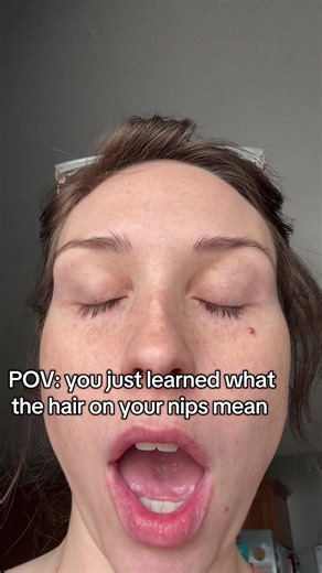 Understanding PCOS and Its Effects on Women's Health