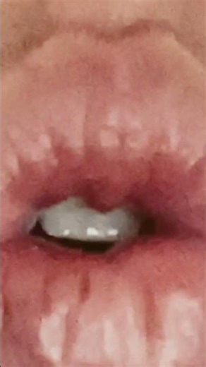 One tooth challenge #onetooth