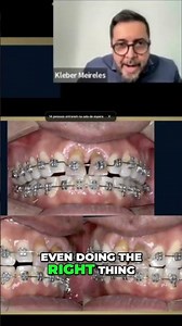 Mastering Force and Line of Action: Strategic Adjustments #shorts