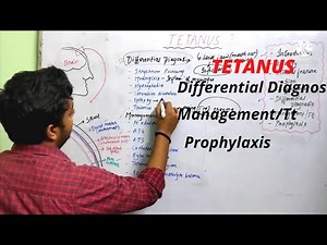 TETANUS - PART 2 ( DIFFERENTIAL DIAGNOSIS, MANAGEMENT/Tt, PROPHYLAXIS) - GENERAL SURGERY