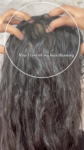 How I control my hair fall check caption #haircare #growhair #longhair