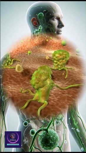 Lymph Node | Structure, Function, and Role in Body Defense