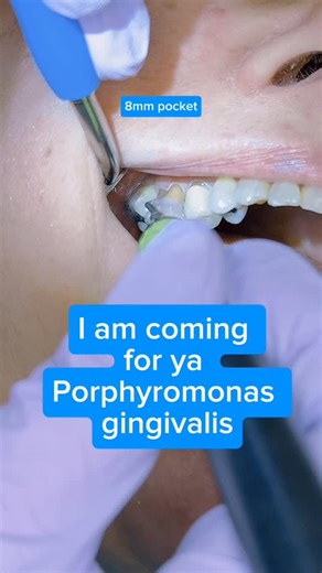 Shelley Brown, MEd, RDH ♡ on Instagram: "We are not tooth scrapers. We are not tooth pickers. We are oral inflammatory therapists. When we treat periodontal disease, we are not simply removing calculus. We are disrupting a pathogenic biofilm ecosystem dominated by keystone organisms like Porphyromonas gingivalis. This bacterium does more than exist in the sulcus. It manipulates the host immune response, alters inflammatory signaling, and increases the virulence of the entire microbial community.