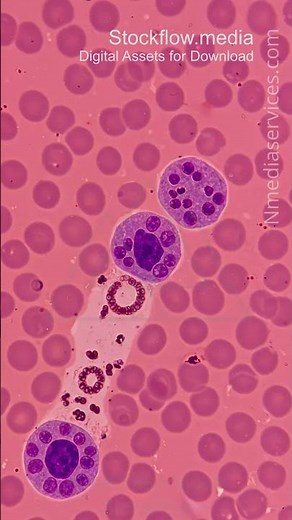 Plasmodium | Parasite | Microscopic - Vertical Stock Footage