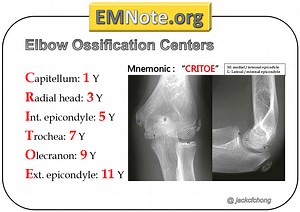 Ossification centers of the elbow