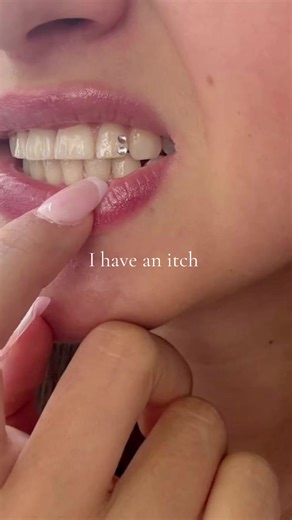 Understanding Tooth Gems: What You Need to Know