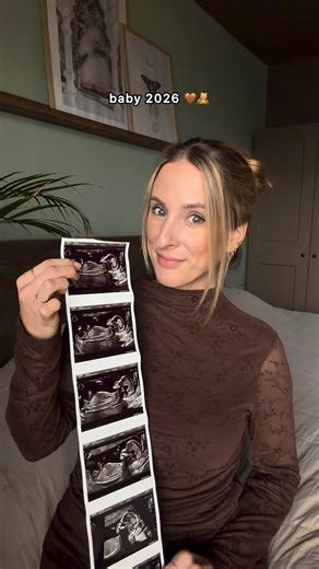 Kim Jacobs on Instagram: "Laat ik beginnen met te zeggen dat ik helemaal rozig ben van jullie honderden (!!) felicitaties en lieve woorden. Door de jaren heen ben ik misschien een beetje vergeten hoe intens jullie met mij meeleven, en dat jullie dat nog steeds doen. Het voelt nog steeds onwerkelijk dat het nieuws over mijn zwangerschap nu openlijk bekend is. 17 weken lang hebben we er in stilte van genoten, in onze eigen bubbel. Maar om eerlijk te zijn voelde het eerste trimester allesbehalve fi