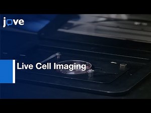Live Cell Imaging of Virus Anterograde Transport and Spread | Protocol Preview