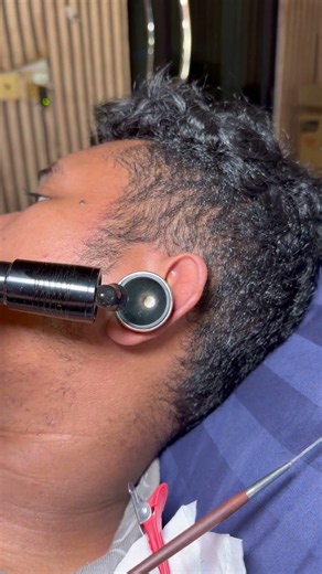 ASMR cleaning ear removal wax