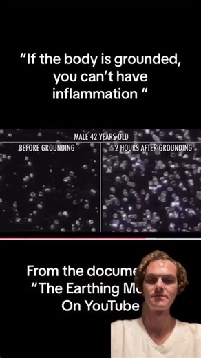 🌿THE MEDICINE FAMILY🌿 on Instagram: "Ground yourself for a minimum of 15 minutes daily. The science is absolutely undeniable. Putting your feet directly on Pachamama reduces inflammation throughout the entire body, lowers depression & anxiety and has numerous health benefits 👣 Remixed from 🌟@begrounded_🌟 🎥 “The Earthing Movie” on YouTube"