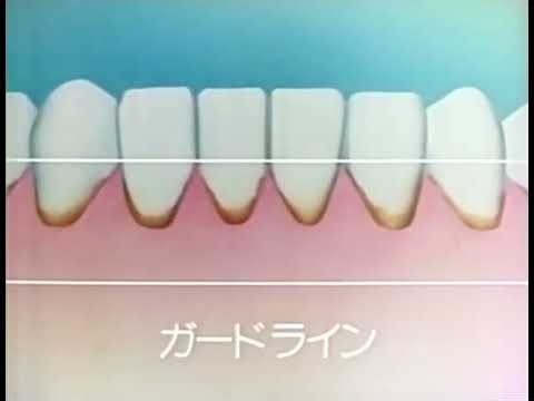 花王 ガードハロー CM 森次晃嗣(1979年)
