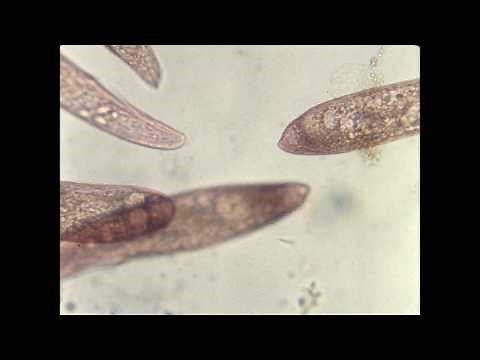 54A. Blepharisma [from A/B masters]