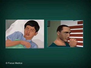 Coccidiodomycosis-Microbiology