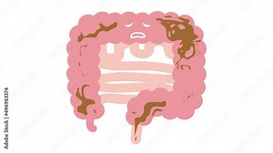 腸（下痢）のアニメーション動画（ループ可） 内臓 消化器