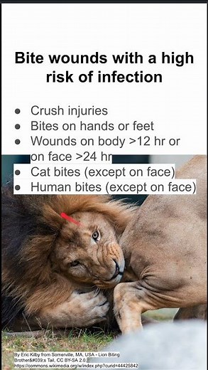 Bite wounds with a high risk of infection