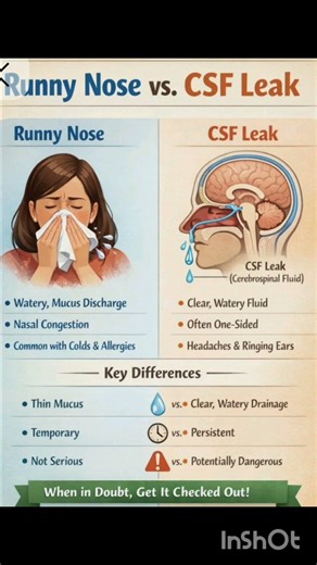 Runny Nose or Brain Leak? 😳 | Don’t Ignore This Sign #medicalshorts
