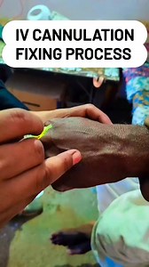 Vigo fixing 🤔 Short videos #reelsvideoシ #fbreelsfypシ゚ #nursing #reelsfypシ #reelschallenge #viralreelschallenge #reelsfacebook #viralvideochallenge #socialmedia #trendingreel | Medical Info Tips