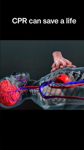 How to Perform CPR Correctly | Save a Life in Emergency.