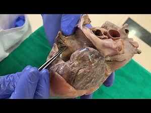 Dissection Interior of right atrium of heart