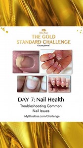 2.7K views · 18 reactions | Nail health issues can be TERRIFYING! If...