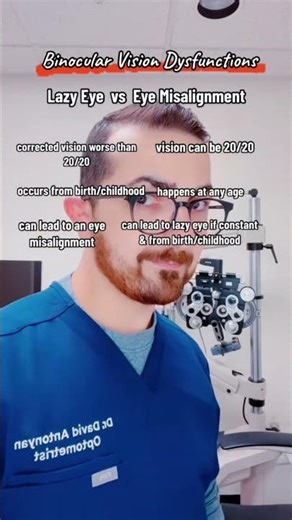 Lazy eye vs eye misalignment… they are NOT the same thing, even though both fall under binocular
