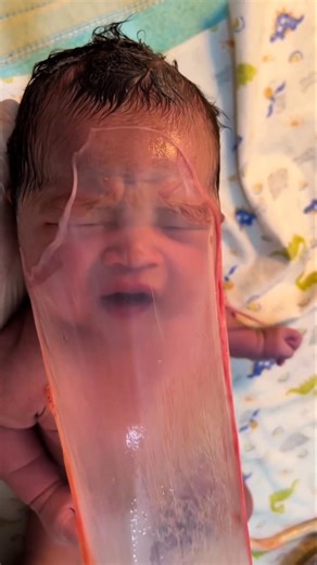 Why Do Doctors Remove Layers from Newborns? #shorts​