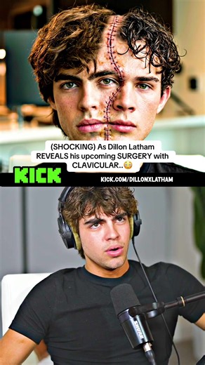 (SHOCKING) As Dillon Latham REVEALS his upcoming SURGERY with Clavicular..😳 #dillonlatham #clavicular #foryou #fyp