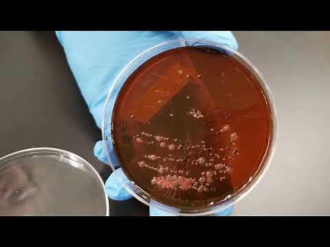 Microbiology of Water: Confirmed Test