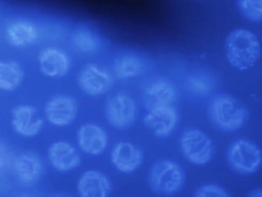 Basic Caenorhabditis elegans Methods: Synchronization and Observation