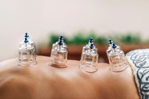 Hijama : principe, bienfaits, points, dangers