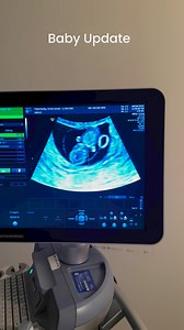 Today Annie graduated from the IVF doctor in LA and it is just incredible to see and hear the baby’s magical heartbeat. I am so thankful to the entire staff at @hrcfertility and @drboostanfarivf and of course our coordinator @hunnynutcheeri0s and all of the folks @altopharmacy and @posterity_health for their assistance in this Journey. I am so proud of @annie_suwan_toborowsky for all she has endured during this process. #90dayfiance #90dayfiancepillowtalk #davidandannie #davidandannieafterthe90d