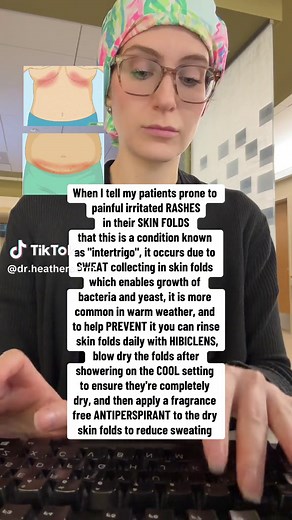 Intertrigo Treatment and Prevention | Dermatology Tips