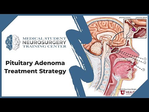 Pituitary Adenoma Treatment Strategy