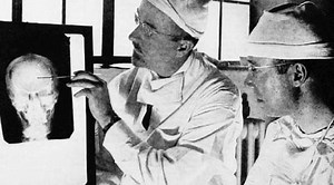 An ice pick to the brain: The horror of the frontal lobotomy