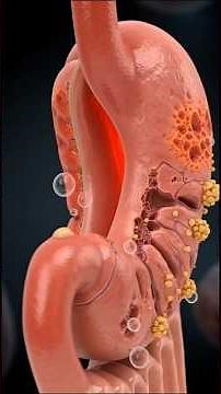 Hot Dog Digestion Explained Inside Human Body!Inside Your Body!Hot Dog Effect!This Happens!