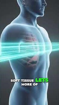 The Incredible Future of X-Ray Tech