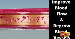 A Fast and Painless Solution to Treat E.D