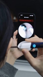 👂 LED Ear Cleaner Tool｜ Yes—it lights up. This smart ear cleaner gives you a safe, clear view while staying gentle and precise. A weirdly satisfying upgrade for your routine. 👉🏻Click the link and grab yours now. Only for new app users with qualifying orders. T&Cs apply. #CleanTech #GroomingTools #TemuFinds | Fabio tech