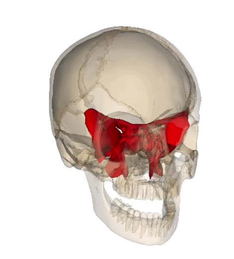 The sphenoid bone is a central, butterfly-shaped unpaired bone at the base of the skull (often called the