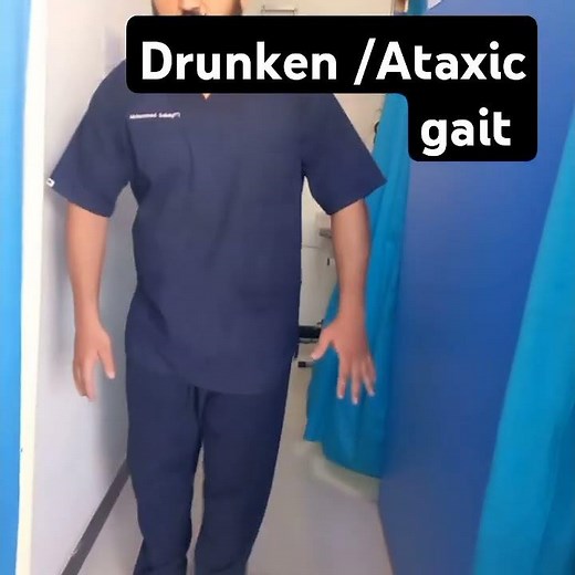 Ataxic /Drunken gait #physiotherapist