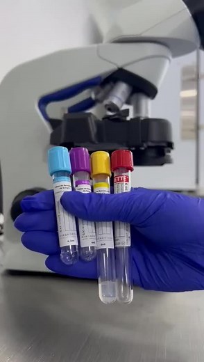 Tipos de tubos de laboratorio y sus usos