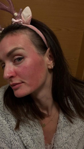 Říkám, že mám tu pleť fakt citlivou 😅🙏🏻. Tak vo co tady jde? #hořímiksicht | Tereza Klavíková