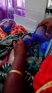 2M views · 19K reactions | Newborn baby resuscitation #newborn #nicu | Medical practice | Facebook