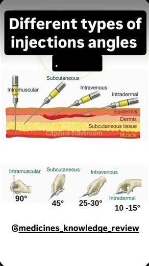 #💉Different types of injections angles💉