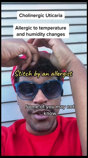 Understanding Cholinergic Urticaria: Causes, Symptoms, and Treatment