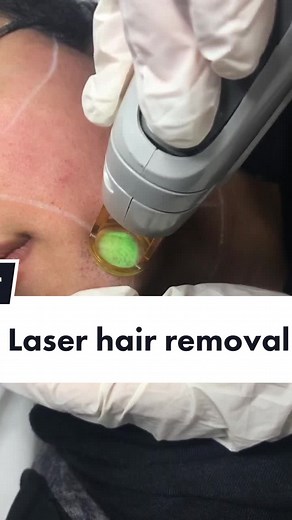 Effective Laser Hair Removal Treatment Explained