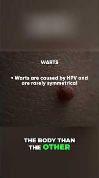 Genital Bumps Explained: Warts vs. Angiokeratoma vs. Cysts #shorts