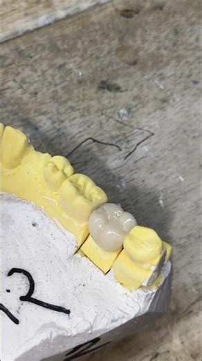 How to Make teeth Project