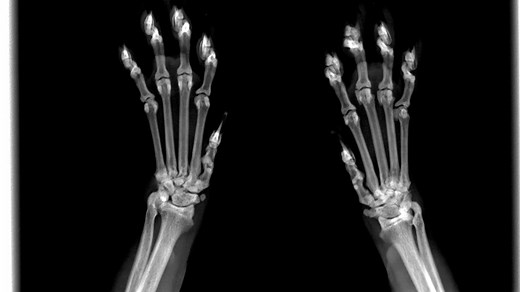 Cat Paw X ray - See Inside Your Cat's Paws Without Surgery - Petsmartgo